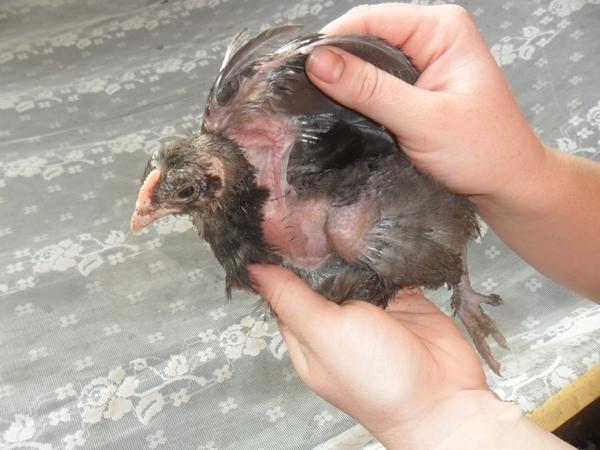 Contre-indications du métronidazole