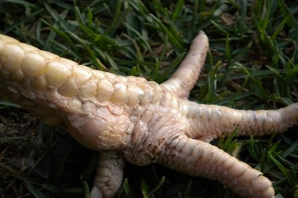 Urolithiasis-Diathese