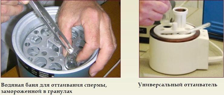 congélation du sperme